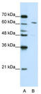 Cleavage and polyadenylation specificity factor subunit 6 antibody, TA345993, Origene, Western Blot image 