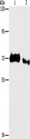 B7RP-1 antibody, TA350632, Origene, Western Blot image 