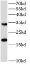 Eukaryotic Translation Initiation Factor 4E Binding Protein 1 antibody, FNab10129, FineTest, Western Blot image 