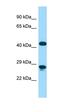 Cerebellar Degeneration Related Protein 2 Like antibody, orb324778, Biorbyt, Western Blot image 