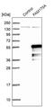 Family With Sequence Similarity 170 Member A antibody, PA5-58158, Invitrogen Antibodies, Western Blot image 