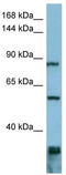 Epidermal Growth Factor Receptor Pathway Substrate 8 antibody, TA335075, Origene, Western Blot image 