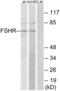 Follicle Stimulating Hormone Receptor antibody, abx015281, Abbexa, Western Blot image 