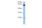 Sterile Alpha Motif Domain Containing 15 antibody, GTX45839, GeneTex, Western Blot image 