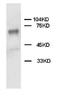 Protein Tyrosine Phosphatase Non-Receptor Type 11 antibody, orb18090, Biorbyt, Western Blot image 
