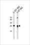 Vesicle Transport Through Interaction With T-SNAREs 1A antibody, PA5-49615, Invitrogen Antibodies, Western Blot image 
