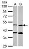 Protoporphyrinogen Oxidase antibody, PA5-28374, Invitrogen Antibodies, Western Blot image 