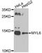 Myosin light polypeptide 6 antibody, STJ111293, St John