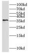CDK-activating kinase assembly factor MAT1 antibody, FNab05252, FineTest, Western Blot image 