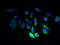 Jagunal Homolog 1 antibody, A66190-100, Epigentek, Immunofluorescence image 