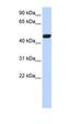 Calcium Voltage-Gated Channel Auxiliary Subunit Beta 4 antibody, orb324660, Biorbyt, Western Blot image 