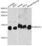 Ubiquitin Conjugating Enzyme E2 D3 antibody, A14640, ABclonal Technology, Western Blot image 