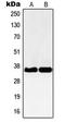 NBPF Member 12 antibody, LS-C353480, Lifespan Biosciences, Western Blot image 