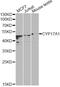 Cytochrome P450 Family 17 Subfamily A Member 1 antibody, MBS127484, MyBioSource, Western Blot image 