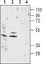 Cholinergic Receptor Nicotinic Alpha 1 Subunit antibody, TA328881, Origene, Western Blot image 