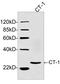Cardiotrophin-1 antibody, LS-C203222, Lifespan Biosciences, Western Blot image 