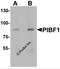 Progesterone Immunomodulatory Binding Factor 1 antibody, 7237, ProSci, Western Blot image 
