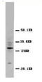 CD40 Ligand antibody, AP23309PU-N, Origene, Western Blot image 