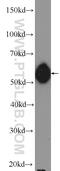 Bifunctional polynucleotide phosphatase/kinase antibody, 13558-1-AP, Proteintech Group, Western Blot image 