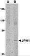 Junctophilin 1 antibody, 4917, ProSci Inc, Western Blot image 