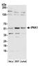 Inositol Hexakisphosphate Kinase 1 antibody, A305-628A-M, Bethyl Labs, Western Blot image 