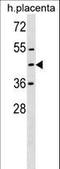 Zinc Finger Protein 558 antibody, LS-C157471, Lifespan Biosciences, Western Blot image 