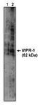 Vasoactive intestinal polypeptide receptor 1 antibody, MBS395349, MyBioSource, Western Blot image 