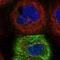 Tumor Associated Calcium Signal Transducer 2 antibody, NBP1-92533, Novus Biologicals, Immunofluorescence image 