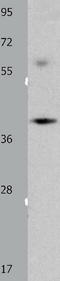 OBCAM antibody, TA321261, Origene, Western Blot image 
