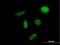 Solute Carrier Family 29 Member 2 antibody, H00003177-B02P, Novus Biologicals, Immunocytochemistry image 