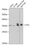 CTSV antibody, GTX55550, GeneTex, Western Blot image 