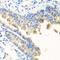 Nyctalopin antibody, orb373794, Biorbyt, Immunohistochemistry paraffin image 