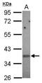 Killer cell immunoglobulin-like receptor 2DS2 antibody, PA5-31465, Invitrogen Antibodies, Western Blot image 