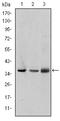 LIM Zinc Finger Domain Containing 1 antibody, A04072, Boster Biological Technology, Western Blot image 