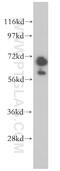 Gigaxonin antibody, 14305-1-AP, Proteintech Group, Western Blot image 