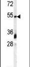 Growth Differentiation Factor 10 antibody, PA5-11927, Invitrogen Antibodies, Western Blot image 