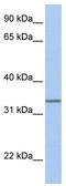SAM Pointed Domain Containing ETS Transcription Factor antibody, TA330587, Origene, Western Blot image 