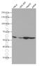 Lactamase Beta antibody, 66785-1-Ig, Proteintech Group, Western Blot image 