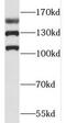 RAB3 GTPase Activating Non-Catalytic Protein Subunit 2 antibody, FNab07031, FineTest, Western Blot image 