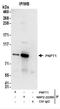 Polyribonucleotide Nucleotidyltransferase 1 antibody, NBP2-22269, Novus Biologicals, Immunoprecipitation image 