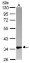 PIN2 (TERF1) Interacting Telomerase Inhibitor 1 antibody, PA5-30659, Invitrogen Antibodies, Western Blot image 