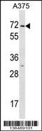 Keratin 75 antibody, 58-736, ProSci, Western Blot image 