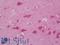 NRP antibody, LS-B12561, Lifespan Biosciences, Immunohistochemistry paraffin image 