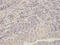 Ribosomal Protein Lateral Stalk Subunit P0 antibody, A04349, Boster Biological Technology, Immunohistochemistry frozen image 