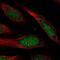 Coiled-Coil Domain Containing 127 antibody, NBP1-91756, Novus Biologicals, Immunofluorescence image 