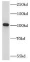 Kinesin Family Member 18A antibody, FNab04553, FineTest, Western Blot image 