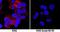 SERPINB2 antibody, MAB8550, R&D Systems, Immunocytochemistry image 
