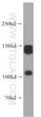 Xanthine Dehydrogenase antibody, 55156-1-AP, Proteintech Group, Western Blot image 