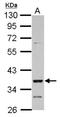 Doublesex- and mab-3-related transcription factor 1 antibody, NBP2-16179, Novus Biologicals, Western Blot image 