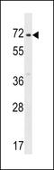 Zinc Finger Protein 155 antibody, 58-838, ProSci, Western Blot image 